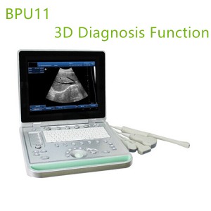 3D laptop ultrasound machines,portable ultrasound scanner,laptop echo machines,medical scan machines,usg ,ultrasound machine price.