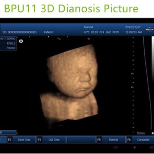 3D laptop ultrasound machines,portable ultrasound scanner,laptop echo machines,medical scan machines,usg ,ultrasound machine price.