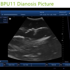 3D laptop ultrasound machines,portable ultrasound scanner,laptop echo machines,medical scan machines,usg ,ultrasound machine price.