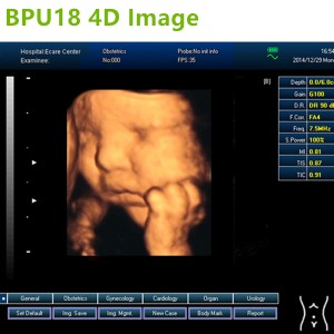laptop ultrasound machines,3D ultrasound machines,4Dultrasound machines,4D Laptop ultrasound machines,4D echo machines,4D Usg ,4D low price ultrasound scanner ,Cheap Ultrasound machines