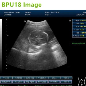 laptop ultrasound machines,3D ultrasound machines,4Dultrasound machines,4D Laptop ultrasound machines,4D echo machines,4D Usg ,4D low price ultrasound scanner ,Cheap Ultrasound machines