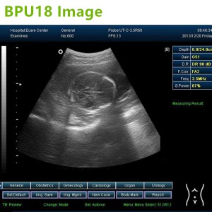 laptop ultrasound machines,3D ultrasound machines,4Dultrasound machines,4D Laptop ultrasound machines,4D echo machines,4D Usg ,4D low price ultrasound scanner ,Cheap Ultrasound machines
