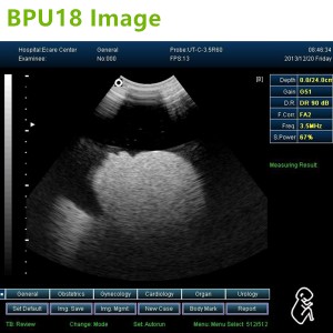laptop ultrasound machines,3D ultrasound machines,4Dultrasound machines,4D Laptop ultrasound machines,4D echo machines,4D Usg ,4D low price ultrasound scanner ,Cheap Ultrasound machines