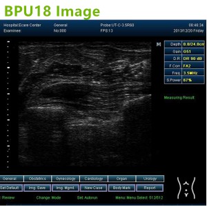 laptop ultrasound machines,3D ultrasound machines,4Dultrasound machines,4D Laptop ultrasound machines,4D echo machines,4D Usg ,4D low price ultrasound scanner ,Cheap Ultrasound machines