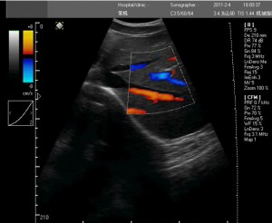 3D doppler ultrasound machines,color ultrasound machines,portable doppler echo machines ,ultrasound scan machines,doppler portable ultrasound machine,cheap color ultrasound machines