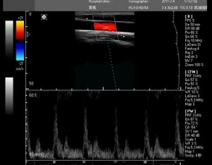 3D doppler ultrasound machines,color ultrasound machines,portable doppler echo machines ,ultrasound scan machines,doppler portable ultrasound machine,cheap color ultrasound machines