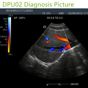 doppler ultrasound machines,color ultrasound machines,portable doppler echo machines ,ultrasound scan machines,doppler portable ultrasound machine,cheap color ultrasound machines