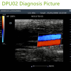 doppler ultrasound machines,color ultrasound machines,portable doppler echo machines ,ultrasound scan machines,doppler portable ultrasound machine,cheap color ultrasound machines