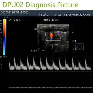 doppler ultrasound machines,color ultrasound machines,portable doppler echo machines ,ultrasound scan machines,doppler portable ultrasound machine,cheap color ultrasound machines