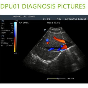 doppler ultrasound machines,color ultrasound machines,portable doppler echo machines ,ultrasound scan machines,doppler portable ultrasound machine,cheap color ultrasound machines
