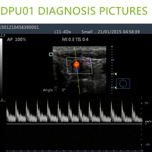 doppler ultrasound machines,color ultrasound machines,portable doppler echo machines ,ultrasound scan machines,doppler portable ultrasound machine,cheap color ultrasound machines