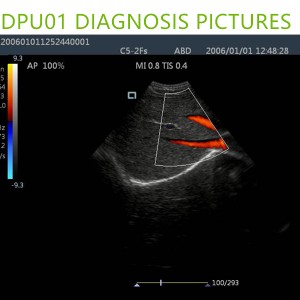 doppler ultrasound machines,color ultrasound machines,portable doppler echo machines ,ultrasound scan machines,doppler portable ultrasound machine,cheap color ultrasound machines