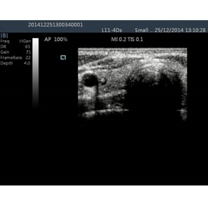 laptop ultrasound machines,lightweight ultrasound machine price,used portable ultrasound machine,best laptop ultrasound machine,portable ultrasound factory sell directly,price from medical ultrasound,medical scan machines