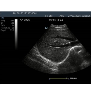 laptop ultrasound machines,lightweight ultrasound machine price,used portable ultrasound machine,best laptop ultrasound machine,portable ultrasound factory sell directly,price from medical ultrasound,medical scan machines