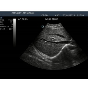 laptop ultrasound machines,lightweight ultrasound machine price,used portable ultrasound machine,best laptop ultrasound machine,portable ultrasound factory sell directly,price from medical ultrasound,medical scan machines