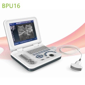 Laptop ultrasound machine,Laptop ultrasound machine price,used Laptop ultrasound machine,best laptop ultrasound machine,laptop ultrasound factory sell directly,price from medical ultrasound
