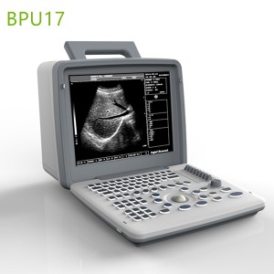 Laptop ultrasound machine,Laptop ultrasound machine price,used Laptop ultrasound machine,best laptop ultrasound machine,laptop ultrasound factory sell directly,price from medical ultrasound