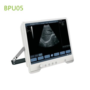 Touchscreen ultrasound machines,portable ultrasound machine price,used portable ultrasound machine,best laptop ultrasound machine,portable ultrasound factory sell directly,price from medical ultrasound,medical scan machines