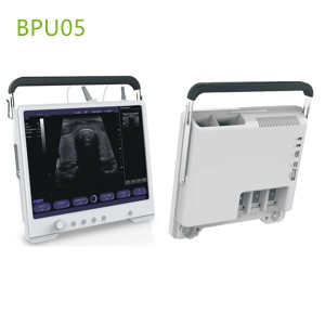 Touchscreen ultrasound machines,portable ultrasound machine price,used portable ultrasound machine,best laptop ultrasound machine,portable ultrasound factory sell directly,price from medical ultrasound,medical scan machines