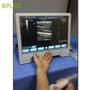 Touchscreen ultrasound machines,portable ultrasound machine price,used portable ultrasound machine,best laptop ultrasound machine,portable ultrasound factory sell directly,price from medical ultrasound,medical scan machines