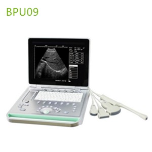 laptop ultrasound machines,portable ultrasound scanner,laptop echo machines,medical scan machines,usg ,ultrasound machine price