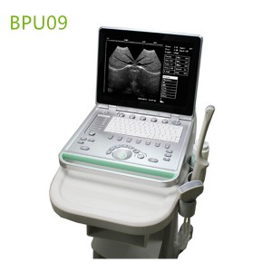 laptop ultrasound machines,portable ultrasound scanner,laptop echo machines,medical scan machines,usg ,ultrasound machine price.