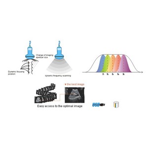 laptop ultrasound machines,portable ultrasound scanner,laptop echo machines,medical scan machines,usg ,ultrasound machine price.