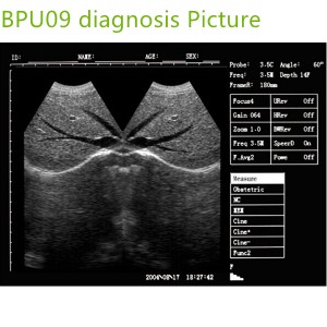 laptop ultrasound machines,portable ultrasound scanner,laptop echo machines,medical scan machines,usg ,ultrasound machine price.