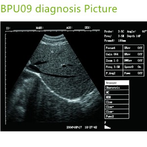 laptop ultrasound machines,portable ultrasound scanner,laptop echo machines,medical scan machines,usg ,ultrasound machine price.