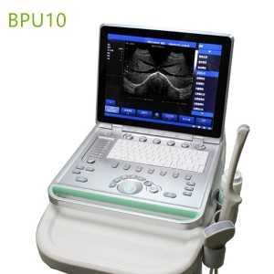 laptop ultrasound machines,portable ultrasound scanner,laptop echo machines,medical scan machines,usg ,ultrasound machine price.
