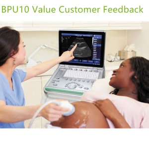 laptop ultrasound machines,portable ultrasound scanner,laptop echo machines,medical scan machines,usg ,ultrasound machine price.