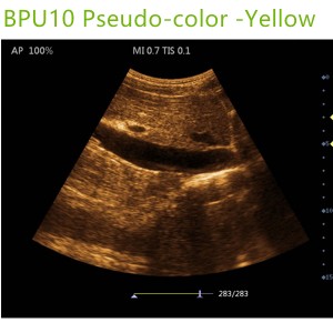 laptop ultrasound machines,portable ultrasound scanner,laptop echo machines,medical scan machines,usg ,ultrasound machine price.