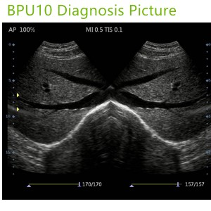 laptop ultrasound machines,portable ultrasound scanner,laptop echo machines,medical scan machines,usg ,ultrasound machine price.