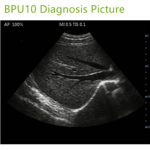 laptop ultrasound machines,portable ultrasound scanner,laptop echo machines,medical scan machines,usg ,ultrasound machine price.