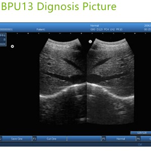 ultrasound machines box,portable ultrasound scanner,laptop echo machines,medical scan machines,usg ,ultrasound machine price.