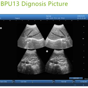 ultrasound machines box,portable ultrasound scanner,laptop echo machines,medical scan machines,usg ,ultrasound machine price.