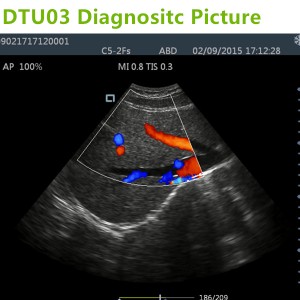 doppler ultrasound machines,trolley doppler ultrasound ,doppler ultrasound scanner,dopper machines,trolley ultrasound machines