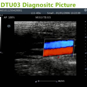 doppler ultrasound machines,trolley doppler ultrasound ,doppler ultrasound scanner,dopper machines,trolley ultrasound machines