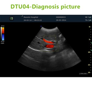 4D ultrasound Machines,4D ultrasound scanner,4d ultrasound scan machine,3D Doppler Ultrasound Machines,3D Color Trolley Ultrasound Machines,Dopper Trolley Ultrasound Machines,Trolley Ultrasound Scanner,best 3D Doppler Ultrasound Machines