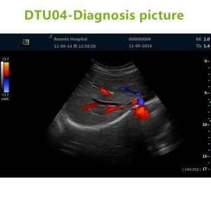 4D ultrasound Machines,4D ultrasound scanner,4d ultrasound scan machine,3D Doppler Ultrasound Machines,3D Color Trolley Ultrasound Machines,Dopper Trolley Ultrasound Machines,Trolley Ultrasound Scanner,best 3D Doppler Ultrasound Machines