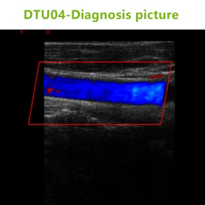 4D ultrasound Machines,4D ultrasound scanner,4d ultrasound scan machine,3D Doppler Ultrasound Machines,3D Color Trolley Ultrasound Machines,Dopper Trolley Ultrasound Machines,Trolley Ultrasound Scanner,best 3D Doppler Ultrasound Machines