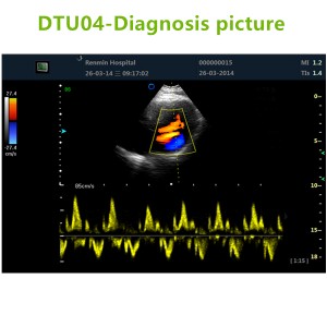 4D ultrasound Machines,4D ultrasound scanner,4d ultrasound scan machine,3D Doppler Ultrasound Machines,3D Color Trolley Ultrasound Machines,Dopper Trolley Ultrasound Machines,Trolley Ultrasound Scanner,best 3D Doppler Ultrasound Machines