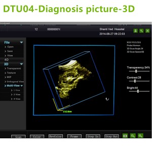 4D ultrasound Machines,4D ultrasound scanner,4d ultrasound scan machine,3D Doppler Ultrasound Machines,3D Color Trolley Ultrasound Machines,Dopper Trolley Ultrasound Machines,Trolley Ultrasound Scanner,best 3D Doppler Ultrasound Machines
