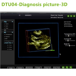 4D ultrasound Machines,4D ultrasound scanner,4d ultrasound scan machine,3D Doppler Ultrasound Machines,3D Color Trolley Ultrasound Machines,Dopper Trolley Ultrasound Machines,Trolley Ultrasound Scanner,best 3D Doppler Ultrasound Machines