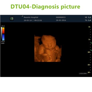 4D ultrasound Machines,4D ultrasound scanner,4d ultrasound scan machine,3D Doppler Ultrasound Machines,3D Color Trolley Ultrasound Machines,Dopper Trolley Ultrasound Machines,Trolley Ultrasound Scanner,best 3D Doppler Ultrasound Machines
