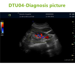4D ultrasound Machines,4D ultrasound scanner,4d ultrasound scan machine,3D Doppler Ultrasound Machines,3D Color Trolley Ultrasound Machines,Dopper Trolley Ultrasound Machines,Trolley Ultrasound Scanner,best 3D Doppler Ultrasound Machines
