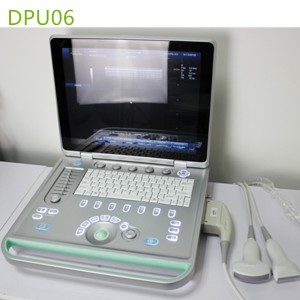 doppler ultrasound echo machines,used doppler ultrasound machines,doppler ultrasound scanner,doppler medical scan machines,doppler ultrasound machines,4d laptop ultrasound machines,portable ultrasound 4d