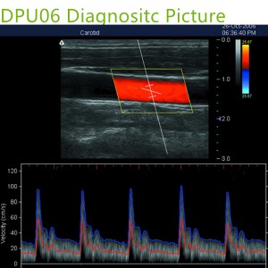 doppler ultrasound echo machines,used doppler ultrasound machines,doppler ultrasound scanner,doppler medical scan machines,doppler ultrasound machines,4d laptop ultrasound machines,portable ultrasound 4d