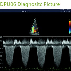 doppler ultrasound echo machines,used doppler ultrasound machines,doppler ultrasound scanner,doppler medical scan machines,doppler ultrasound machines,4d laptop ultrasound machines,portable ultrasound 4d