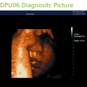 doppler ultrasound echo machines,used doppler ultrasound machines,doppler ultrasound scanner,doppler medical scan machines,doppler ultrasound machines,4d laptop ultrasound machines,portable ultrasound 4d